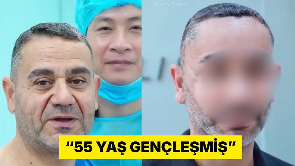 Vietnam'da Estetik Yaptıran 58 Yaşındaki Türk Vatandaşın Değişimi Viral Oldu
