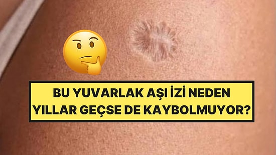 Çocukken Yapılan Aşı Sol Kolumuzda Neden Yuvarlak Bir İz Bıraktı?