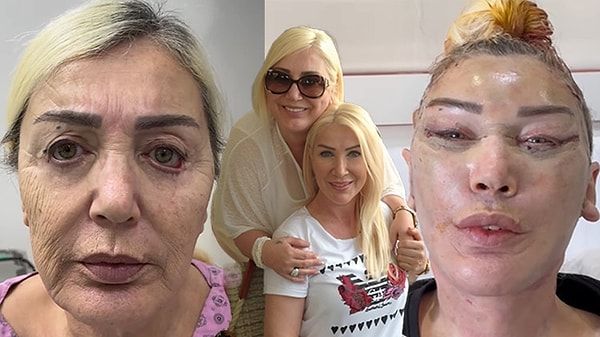 Seda Sayan'ın estetik doktoruna emanet ettiği ablası Nursel Sayan yıllar içerisinde kardeşine öyle bir benzedi ki son aile pozu tabloyu iyice ortaya çıkardı!