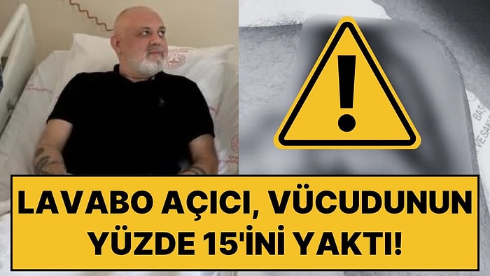 Üzerine Lavabo Açıcı Dökülen Adamın Vücudunun Yüzde 15’i Yandı: “Kot Şortum Erimişti”