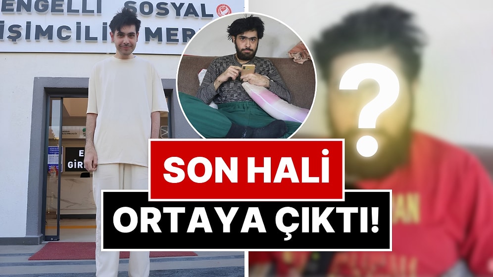 Üç Yıl Evden Çıkmayan Barış Özbay'ın Son Hali Ortaya Çıktı: Tedaviye Devam Etmek İstemediğini Söyledi
