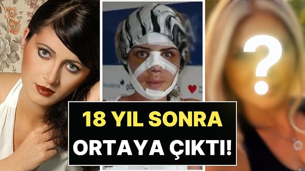 Tansu Çiller Estetiğiyle Şoke Eden Çiğdem Savaş'ın Son Hali