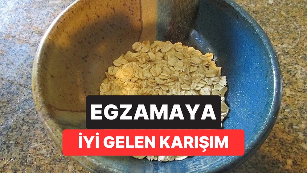 Kaşıntıyı Evde Dindirmek İsteyenler Dikkat: Dermatologlar O Karışımdaki Tek Malzemeye Karşı Uyarıyor