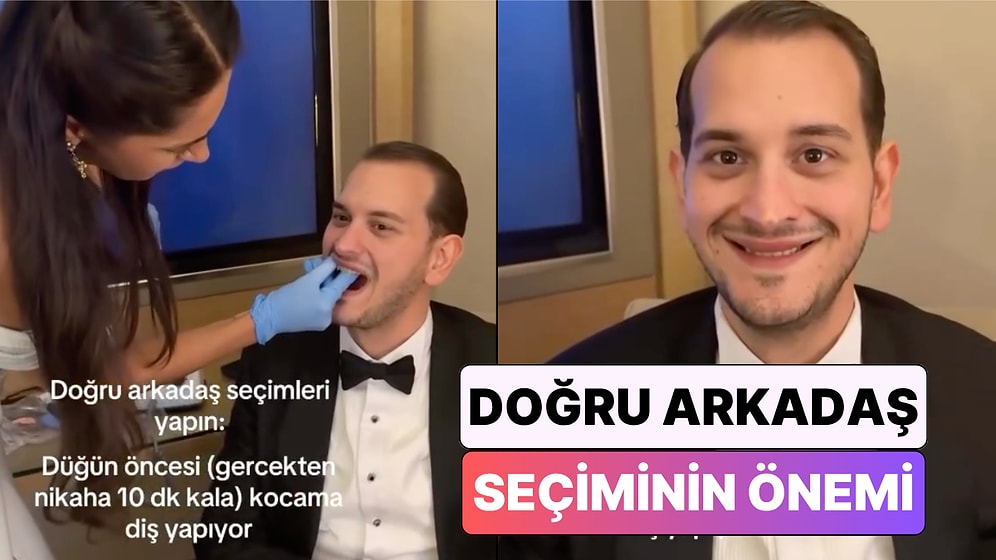 Gelinin Diş Hekimi Arkadaşı Nikaha 10 Dakika Kala Damadın Dişlerini Yaptı