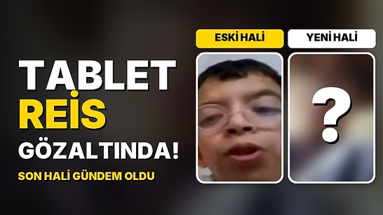 Tablet Reis Onurcan Güzel Gözaltına Alındı: Estetiklerle Değişen Yüzünün Son Hali Gündem Oldu!