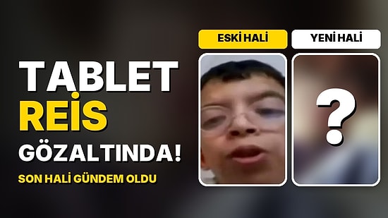 Tablet Reis Onurcan Güzel Gözaltına Alındı: Estetiklerle Değişen Yüzünün Son Hali Gündem Oldu!
