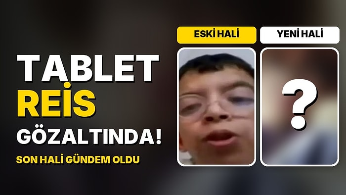Tablet Reis Onurcan Güzel Gözaltına Alındı: Estetiklerle Değişen Yüzünün Son Hali Gündem Oldu!