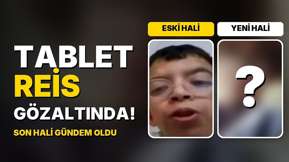 Tablet Reis Onurcan Güzel Gözaltına Alındı: Estetiklerle Değişen Yüzünün Son Hali Gündem Oldu!