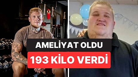 Günde 10 Bin Kalori Alıyordu: Türkiye'de Ameliyat Olan 298 Kiloluk Adam 193 Kilo Verdi