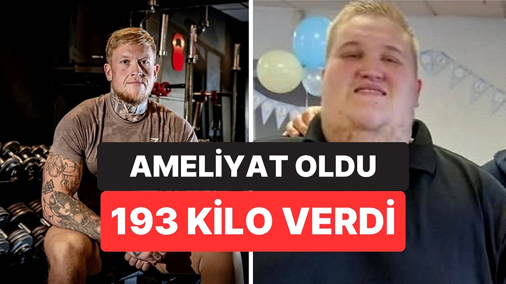 Günde 10 Bin Kalori Alıyordu: Türkiye'de Ameliyat Olan 298 Kiloluk Adam 193 Kilo Verdi