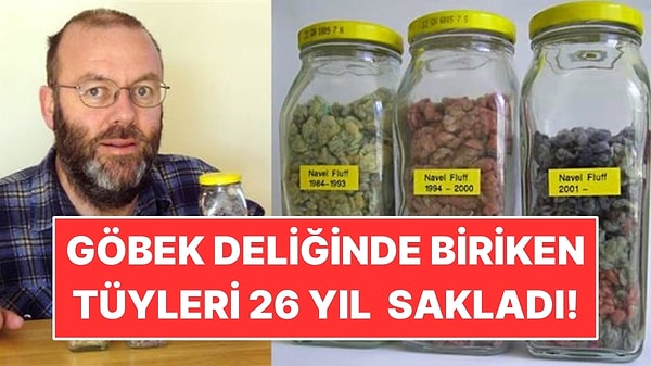 26 Yıl Boyunca Göbek Tüyü Biriktirdi!