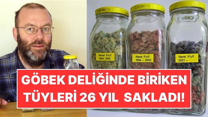 Göbek Deliğinde Biriken Tüyleri 26 Yıl Boyunca Kavanozlarda Sakladı