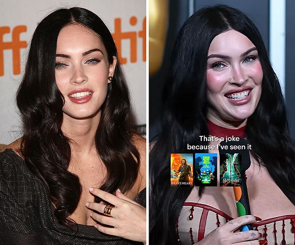 Megan Fox, 2024 yılında katıldığı Call Her Daddy programında yaptırdığı işlemleri saklamadan anlatmıştı.