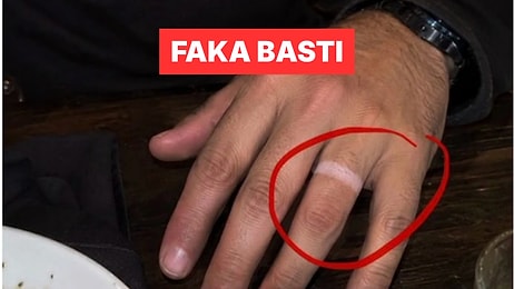 Buluşmada Parmağındaki Yüzük İzine "Doğum Lekesi" Diyen Adam Dünyada Viral Oldu