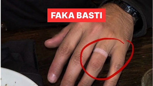 Buluşmada Parmağındaki Yüzük İzine "Doğum Lekesi" Diyen Adam Dünyada Viral Oldu