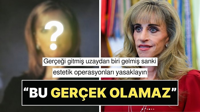 Beyaz Saray'da Herkes Onu Konuştu: Milyarder Michael Dell'in Eşi Susan Dell'in Değişimi Resmen Şoke Etti!