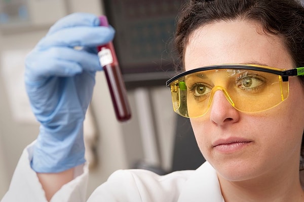 Genç hücrelerde DNA çekirdeğin kenarında sıkı duruyor, yaşlılarda dağılıyor