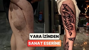 Bir Dövme Sanatçısı Bacaktaki Uzun Yara İzini Harika Bir Tasarımla Kapattı