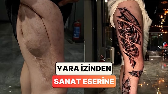 Bir Dövme Sanatçısı Bacaktaki Uzun Yara İzini Harika Bir Tasarımla Kapattı
