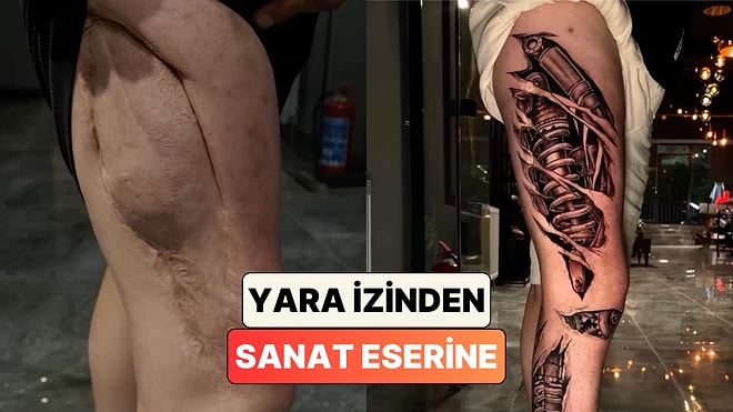 Bir Dövme Sanatçısı Bacaktaki Uzun Yara İzini Harika Bir Tasarımla Kapattı