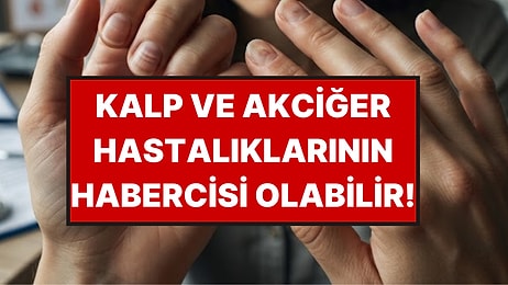 Tırnağınızdaki Bu 7 Değişikliğe Sakın "Geçer" Demeyin
