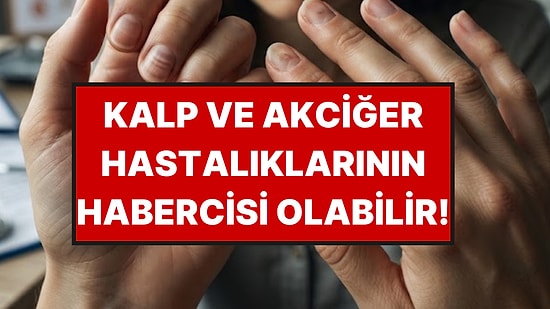 Tırnağınızdaki Bu 7 Değişikliğe Sakın "Geçer" Demeyin