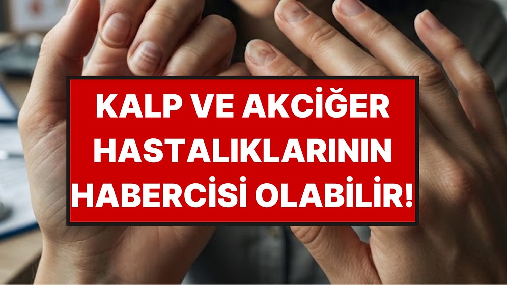 Tırnağınızdaki Bu 7 Değişikliğe Sakın "Geçer" Demeyin