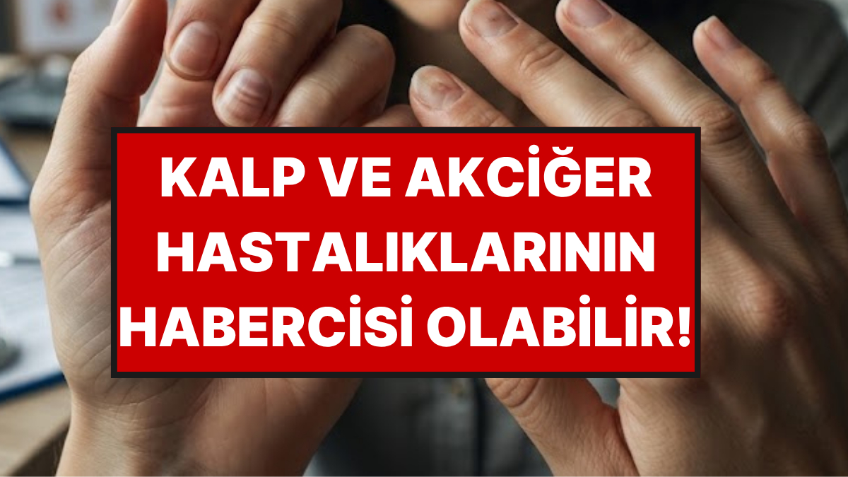 Tırnağınızdaki Bu 7 Değişikliğe Sakın "Geçer" Demeyin