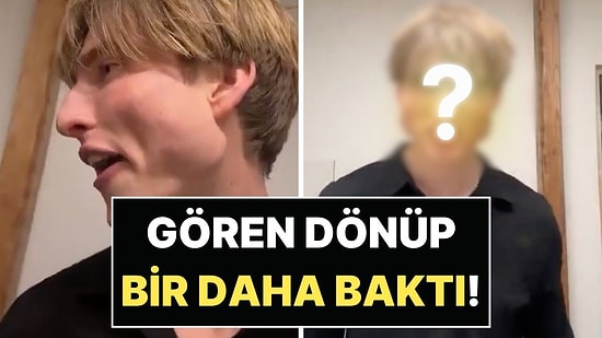 Jawline Egzersizini Abartan Bir Gencin Çenesinin Son Hali Resmen Şoke Etti!