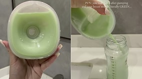 Mother Shocked Viewers After Revealing Her Pumped Breast Milk Turned Green