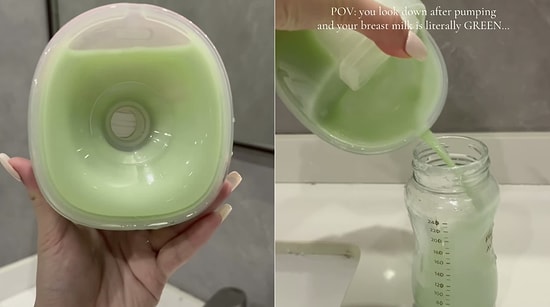 Mother Shocked Viewers After Revealing Her Pumped Breast Milk Turned Green