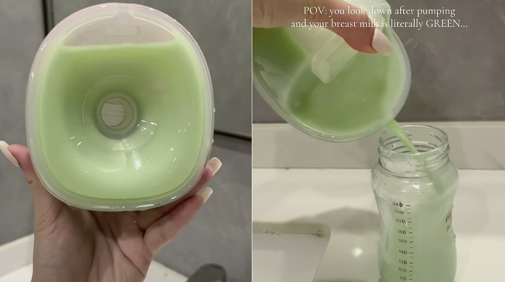 Mother Shocked Viewers After Revealing Her Pumped Breast Milk Turned Green