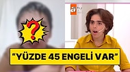 Evli Adama Kaçıp Kumasıyla Aynı Evde Yaşamıştı: Esra Erol'daki Engelli Fatma'nın Son Hali Ortaya Çıktı!