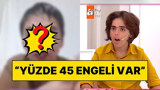 Evli Adama Kaçıp Kumasıyla Aynı Evde Yaşamıştı: Esra Erol'daki Engelli Fatma'nın Son Hali Ortaya Çıktı!