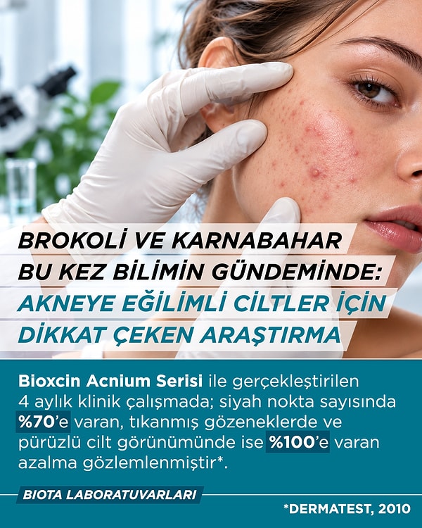 Brokoli ve karnabahar laboratuvarda mercek altına alındı