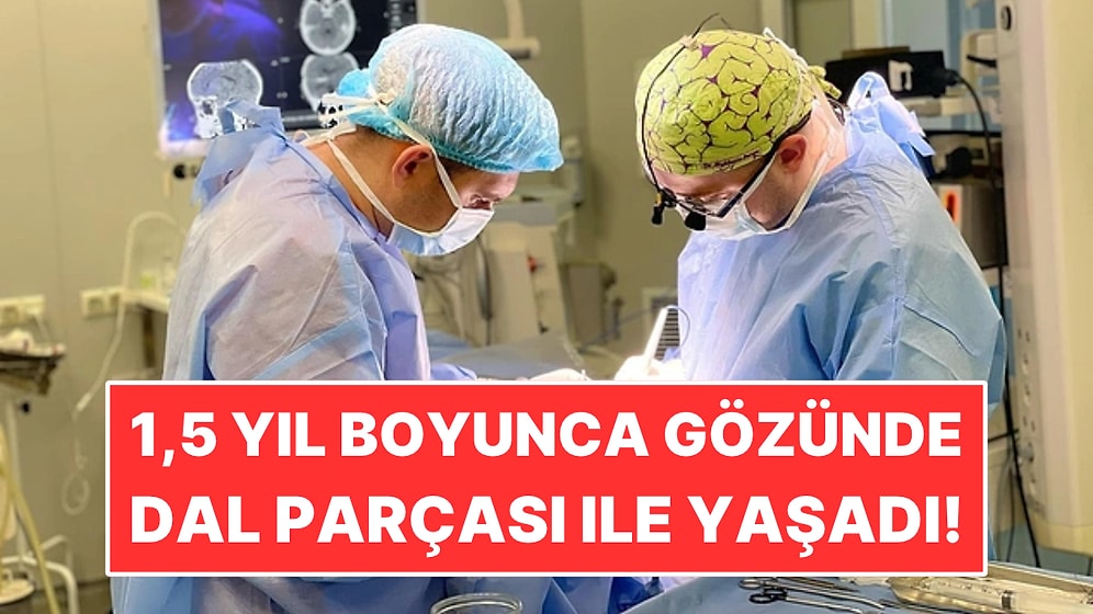 Bir Buçuk Yıl Boyunca Gözünde 12 Santimetrelik Dal Parçasıyla Yaşadı