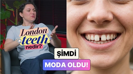 Aralıklı Diş Artık Güzellik Standardı Oldu! Bir Diş Hekimi "London Teeth" Akımını Anlattı