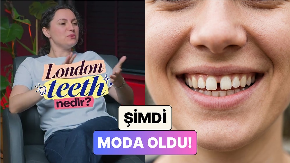 Aralıklı Diş Artık Güzellik Standardı Oldu! Bir Diş Hekimi "London Teeth" Akımını Anlattı