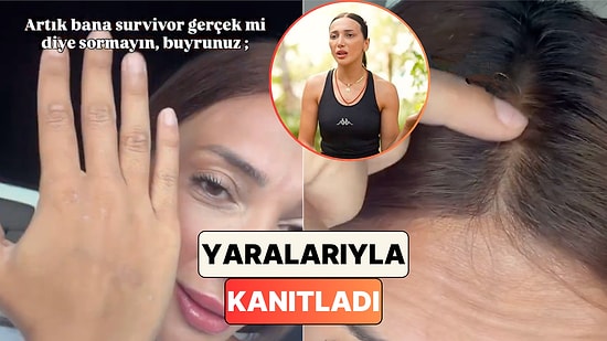 Eski Survivor Yarışmacısı Büşra Yalçın Survivor'dan Sonra Vücudundaki Değişimleri Gösterdi