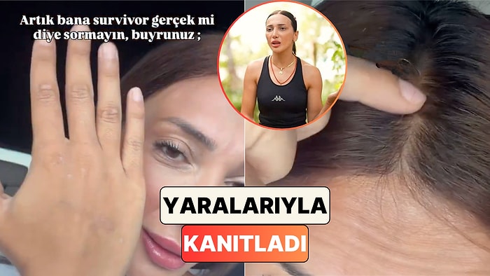 Eski Survivor Yarışmacısı Büşra Yalçın Survivor'dan Sonra Vücudundaki Değişimleri Gösterdi