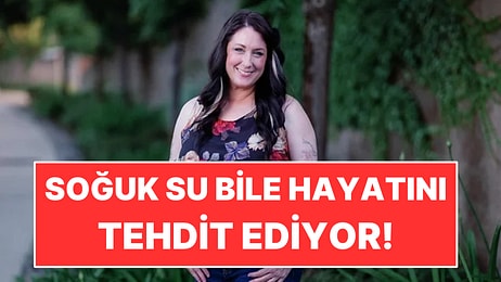 Soğuk Su Bile Hayatını Tehdit Ediyor: Yoğurdu Isıtarak Yiyor