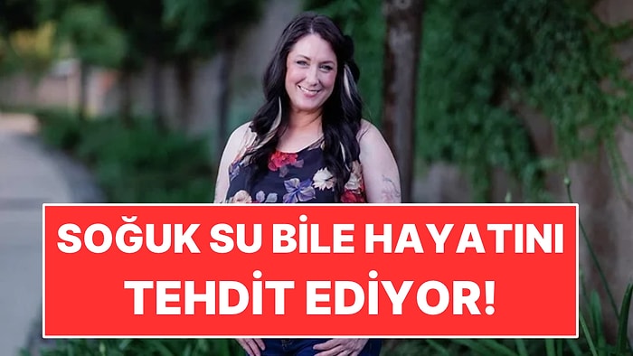 Soğuk Su Bile Hayatını Tehdit Ediyor: Yoğurdu Isıtarak Yiyor