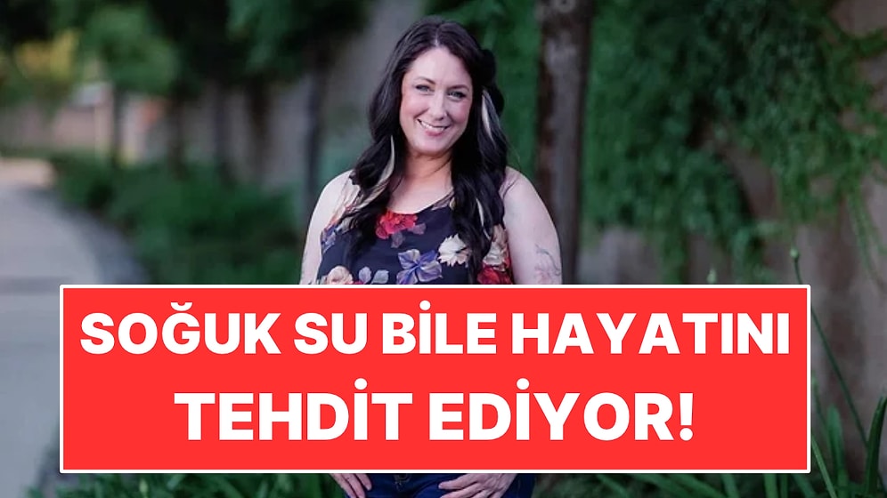 Soğuk Su Bile Hayatını Tehdit Ediyor: Yoğurdu Isıtarak Yiyor
