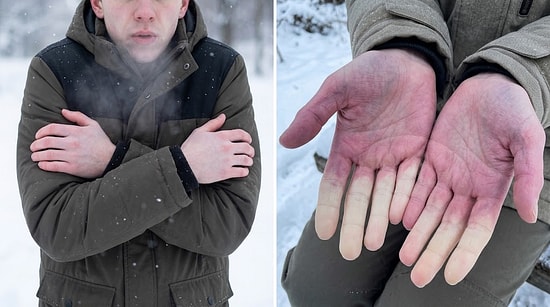 What Constantly Having Cold Feet Reveals About Your Overall Health