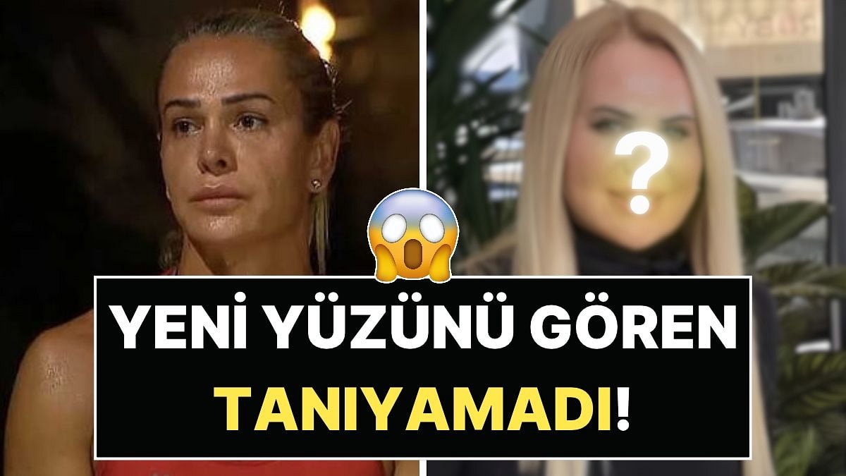 Yüzünü Gerdiren Nagihan Karadere'nin Son Hali Gündem Oldu: Gelen Yorumlara Cevap Verdi!