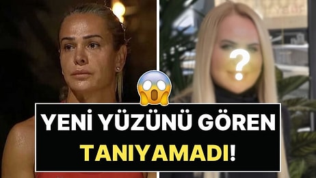 Yüzünü Gerdiren Nagihan Karadere'nin Son Hali Gündem Oldu: Gelen Yorumlara Cevap Verdi!