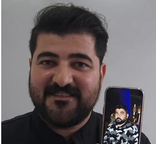 Sivas'ta Eypio'ya benzediği düşünülen diş hekimine hastalar fotoğraf çektirmek için de geliyor