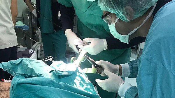 Dolgu damara karışırsa akciğerlerde emboli tablosu gelişebiliyor.