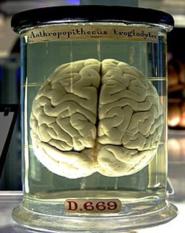 1. "Beynin büyüklüğü zekayı etkiler."
