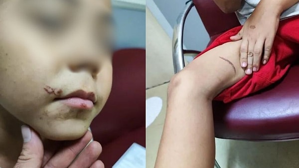 Sabah Gazetesi'nin aktardığına göre, Türkmen uyruklu Azatjan Babakulıyev isimli bir adam, 8 yaşındaki Kudret Hamrayev isimli bir oğuluna cebinden 50 lira aldığı gerekçesiyle kızgın tornovida ile işkence yaptı.